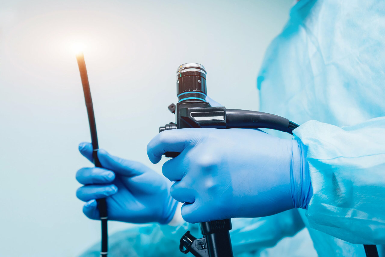 Endoscopy